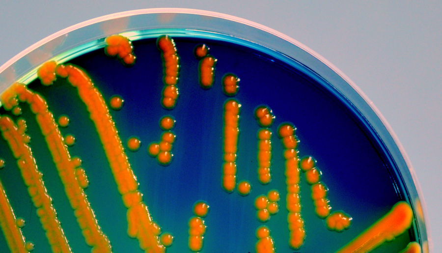 Escherichia coli can cause intestinal and extraintestinal infections in humans and animals