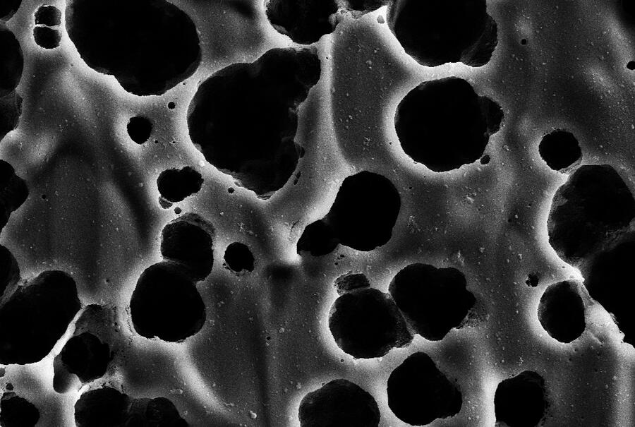 Imaxe de microscopia electrónica de barrido na que se mostra a superficie dunha lámina de PET sendo degradada polo encima immobilizado en nanoesferas proteicas Imaxe de microscopia electrónica de barrido na que se mostra a superficie dunha lámina de PET sendo degradada polo encima immobilizado en nanoesferas proteicas