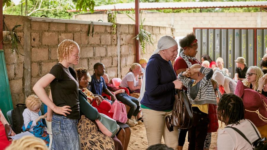 Comunidade albina en Mozambique. FOTO: Fundación Mutua