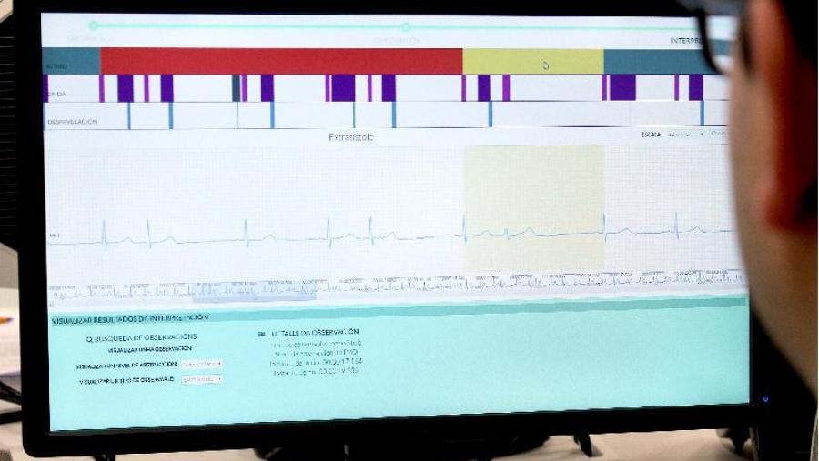 Nace nos laboratorios do CiTIUS da USC o sistema automático máis preciso do mundo para interpretar o electrocardiograma Nace nos laboratorios do CiTIUS da USC o sistema automático máis preciso do mundo para interpretar o electrocardiograma