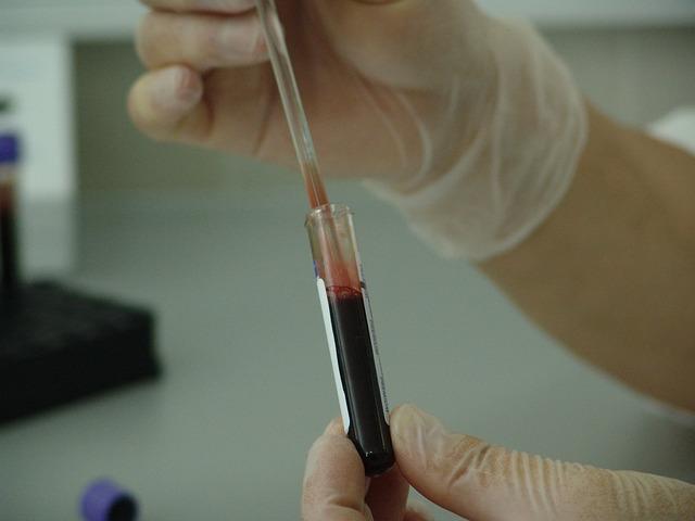 Análise de sangue. Imaxe de PublicDomainPictures en Pixabay