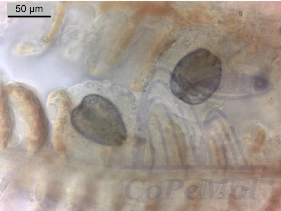  Imaxe de microscopio dun par de gloquidios enquistados nas branquias dun salmón