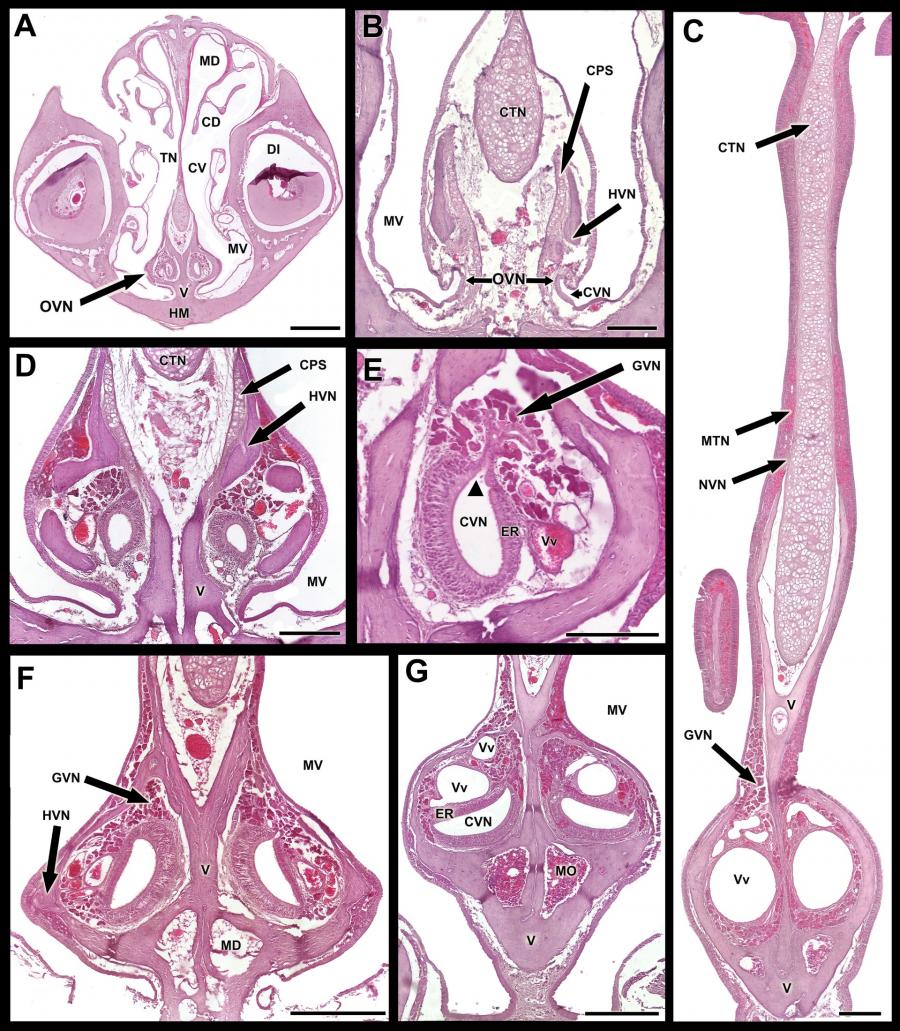 Serie histolóxica de imaxes do órgano vomeronasal da rata toupa incluída no artigo publicado en 'The Anatomical Record'