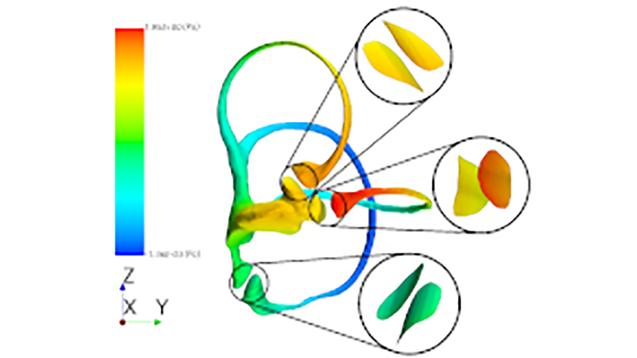 Vestibular system 