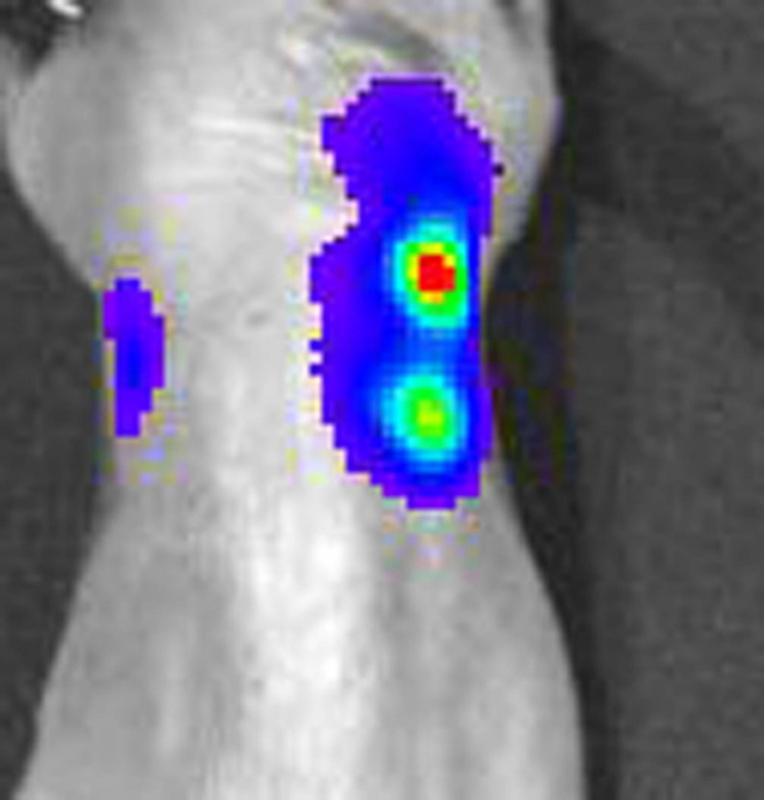 Estudan a introdución no organismo humano de sensores que alertan da presenza e agresividade dun tumor