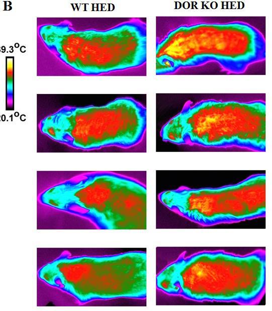 Unha investigación da USC establece unha relación directa entre a obesidade e un receptor celular