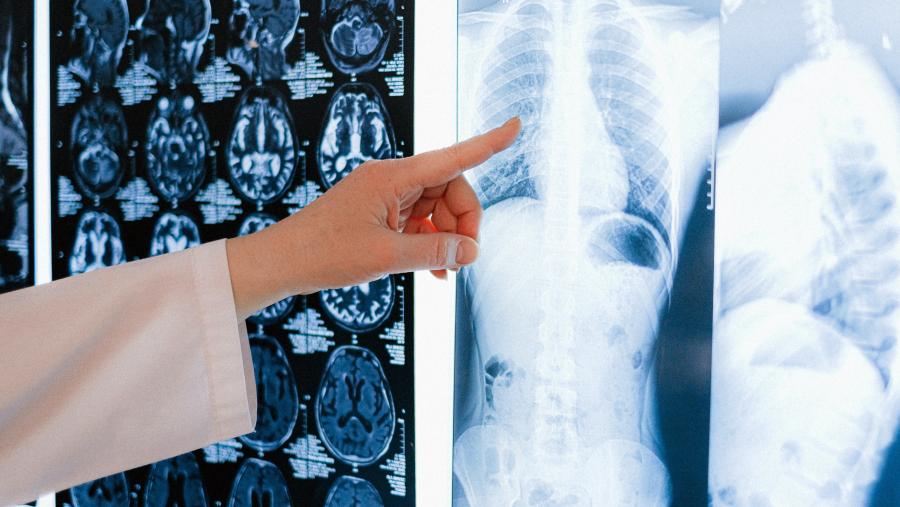 O seminario explora o potencial desta tecnoloxía contra o cancro. FOTO: Pexels 