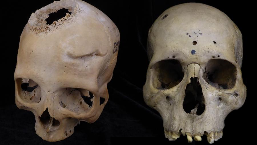 Mostra dos cranios analizados polos investigadores
