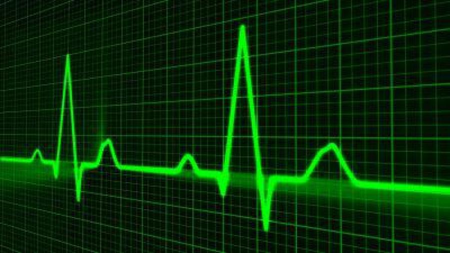 Investigadores do CiTIUS presentan un sistema que detecta por primeira vez calquera anomalía da actividade eléctrica cardíaca en tempo real